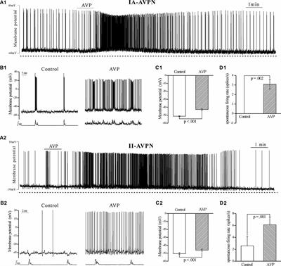 Arginine Vasopressin Alters Both Spontaneous and Phase-Locked Synaptic Inputs to Airway Vagal Preganglionic Neuron via Activation of V1a Receptor: Insights into Stress-Related Airway Vagal Excitation